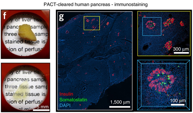 Whole-body tissue stabilization and selective extractions via tissue-hydrogel hybrids for high-resolution intact circuit mapping and phenotyping